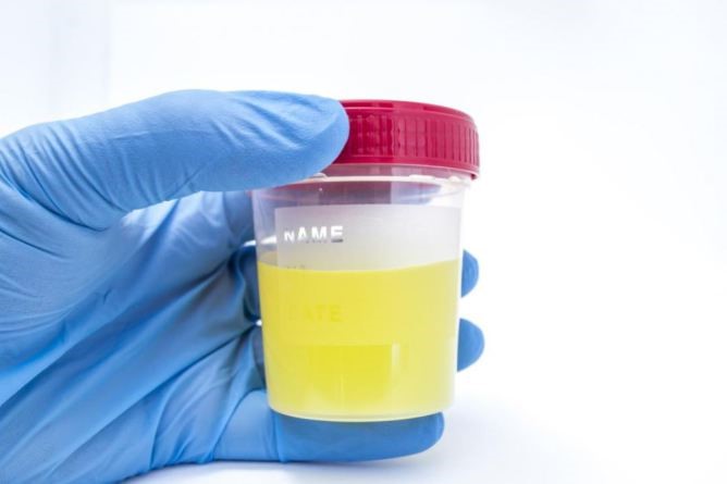 Synthetic Urine Instant Drug Test Marshall Terrace Minneapolis MN